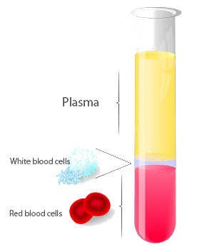 PRP Hair Treatment Dubai at Cosmocare Medical Center